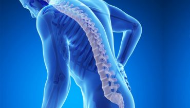 Osteoporosis